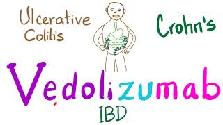 Management of Inflammatory Bowel Disease IBD Crohns and Ulcerative Colitis [upl. by Kellsie395]