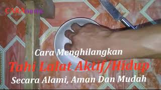 Cara Menghilangkan Tahi Lalat Hidup  Kecantikan  CARAnesia [upl. by Delia]