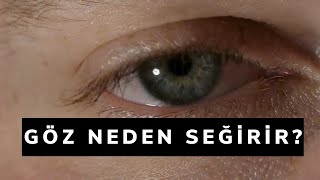 GÖZ SEĞİRMESİ NEDEN OLUR [upl. by Cargian]