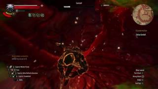 Dettlaff Witcher 3 Wild Hunt How to Beat Dettlaff on Death March [upl. by Acherman572]