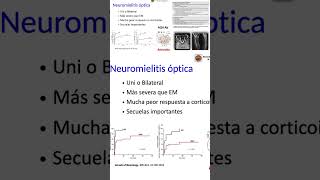 Neuromielitis Óptica [upl. by Alikee]