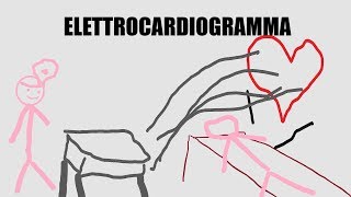 I segreti più o meno dellELETTROCARDIOGRAMMA  Spiegazione [upl. by Shanna47]