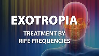 Exotropia  RIFE Frequencies Treatment  Energy amp Quantum Medicine with Bioresonance [upl. by Yroger]