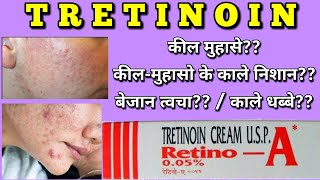 Tretinoin cream  Retino A cream uses side effects how to apply [upl. by Ater]