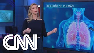 Cigarros eletrônicos não combatem vício e podem causar inflamação pulmonar  Correspondente Médica [upl. by Alvan]