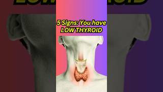 5 Signs that you have LOW THYROID  Hypothyroidism thyroid hypothyroidism healthtips shorts [upl. by Acnalb285]