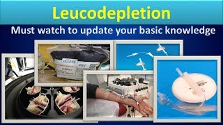 LeucodepletionClear overview [upl. by Enoval]