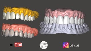 Exocad  Tutorial come creare una protesi mobile PTM senza modulo [upl. by Abehsile214]