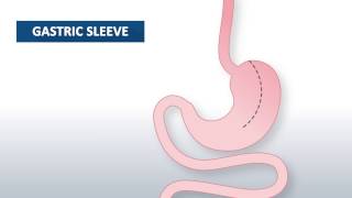 Phases of gastric secretion  Three phases cephalic gastric and intestinal of gastric secretion [upl. by Reaht]