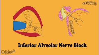 inferior alveolar nerve block in detail [upl. by Hpesojnhoj]