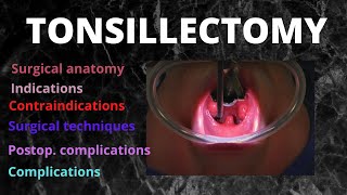 The Tonsils Anatomy and Physiology [upl. by Hahnke]