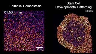 MAPK signaling in homeostasis versus patterning [upl. by Eveineg]