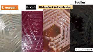 Most Common Bacterial Colony Morphology E coliKlebsiellaPseudomonasProteusStaphylococcusBaci [upl. by May]