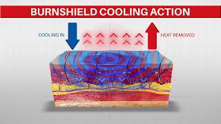 How Does Burnshield Work [upl. by Knowland]