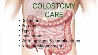 Colostomy Care  Types of Colostomy  Nursing Management [upl. by Henley]