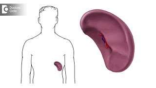 What causes a spleen to enlarge Can you a shrink an enlarged spleen  Dr Lorance Peter [upl. by Bessie830]