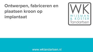 Ontwerpen fabriceren en plaatsen kroon op implantaat in Apeldoorn [upl. by Tenej58]