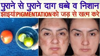 Kale Nishan Daag Dhabbe Jhainyan ko dur Karne ka Nuskha by Beauty Secrets Hindi [upl. by Nevetse24]