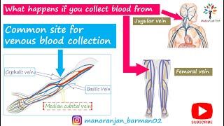 Common venipuncture sites  Venipuncture sites that need expertise  Medical Lab Tech [upl. by Darcie9]