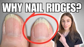 Why You Have Vertical Nail Ridges And How To Get Rid Of Them [upl. by Renwick]