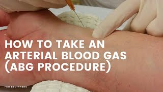 How to take blood for ABG Arterial blood gas [upl. by Madson947]