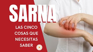 SARNA  Las 5 cosas que necesitas saber [upl. by Nnhoj]