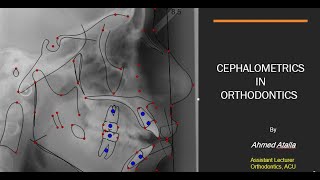 Cephalometrics in orthodontics By Dr Ahmed Atalla [upl. by Todhunter418]