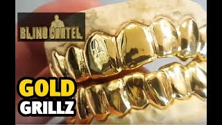 Custom Gold Teeth Grillz  BlingCartelcom [upl. by Joya]