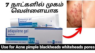 Adapalene gel uses in tamil  best oilment to reduce pimple and acne  skin whitening cream [upl. by Cila]