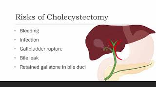 What is Laparoscopic Cholecystectomy [upl. by Neenad]