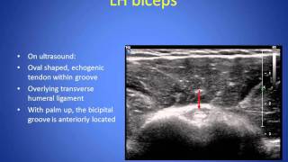 US Guided Shoulder Interventions  Campbellmp4 [upl. by Namya]