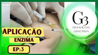 Aplicação de enzima para gordura localizada  Desafio Emagrecer 3kg em 30 dias [upl. by Lyrahc]