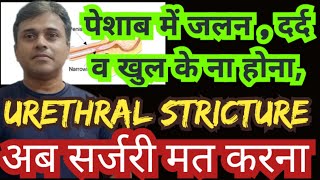 urethral stricture treatment with homeopathic medicines [upl. by Kendre]