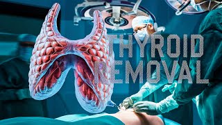 See How Inflamed Thyroid Is Removed From Patients  Health 3d Animation [upl. by Trever]