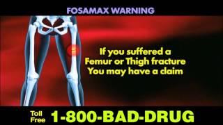 Fosamax Femur Fracture Claims [upl. by Neau]