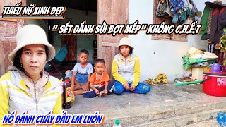 Thiếu Nữ Xinh Đẹp Ở Trên Núi Bị Sét Đánh “ SÙI BỌT MÉP “ Cháy Cả Da Đầu Không Chết  351 [upl. by Scheck137]