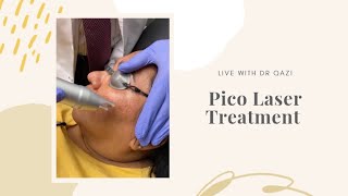 Pico Laser Treatment For Melasma LIVE [upl. by Yecnahc439]