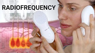 Radiofrequency Skin Tightening Treatments  Do They Really Work amp If So How Nebulyft Science [upl. by Diad691]