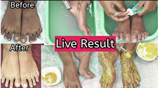 Feet Whitening Pedicure At Home  Remove Suntan amp Whiten Your Skinkanmani beauty tips [upl. by Yenattirb]