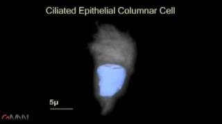 Sputum Samples amp Lung Cancer [upl. by Pillsbury]