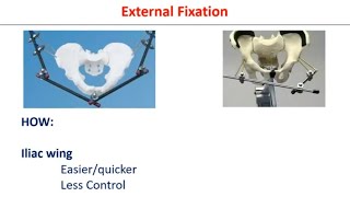 Osteitis Pubis  Treatment Methods [upl. by Hassadah580]