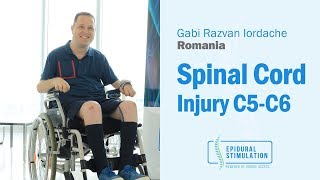 C5C6 Spinal Cord Injury Patient Gabi from Romania Makes Great Progress After Epidural Stimulation [upl. by Ardried201]