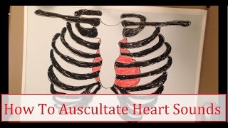 How To Auscultate Heart Sounds [upl. by Anirahc595]