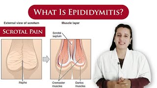 What is Epididymitis  causes symptoms treatment  scrotal pain  By Dr N Joshi [upl. by Fassold]