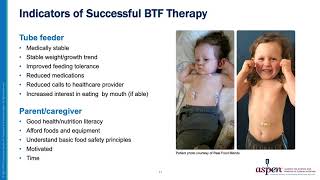 Pediatric Blenderized Tube Feeding An Update [upl. by Rhodes208]