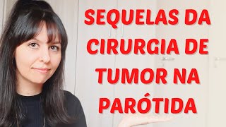 Cirurgia de retirada do tumor na parotida [upl. by Rubbico]