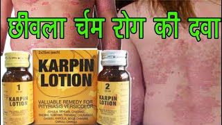 KARPIN LOTION  Full Hindi Review [upl. by Ahsenik]