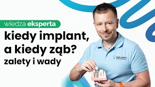 POJEDYNCZY IMPLANT  PROCES WSZCZEPIENIA IMPLANTU BEZ TAJEMNIC [upl. by Rento]