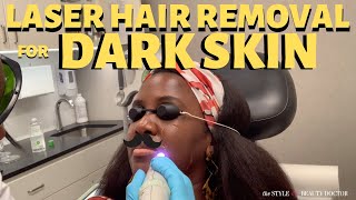 Getting Laser Hair Removal on Dark Skin Cutera 1064 Laser [upl. by Raouf381]