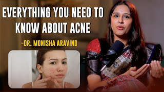 Treatment பண்ணியும் Acne போகலையா காரணம் இதான்  DrMonisha Aravind [upl. by Alansen]